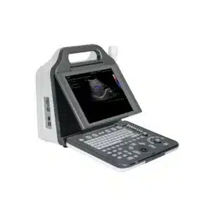 G20 FULL DIGITAL COLOR DOPPLER ULTRASOUND DIAGNOSTIC SYSTEM