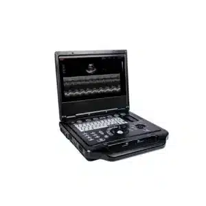 G33 Ultrasound Diagnostic System