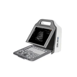N2 Ultrasound Diagnostic System