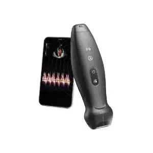 TE Air Wireless Handheld Ultrasound