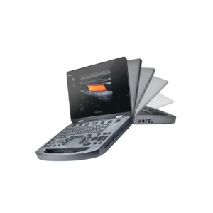 MX3 Compact Ultrasound System