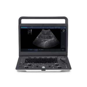 Sonoscape E1 Portable Color Doppler Ultrasound