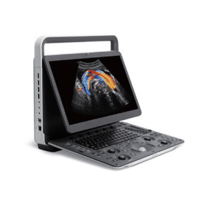 Sonoscape E2 Portable Color Doppler Ultrasound
